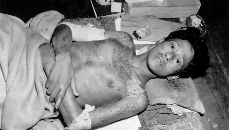 Nagasaki’nin 80 Yıl Sonra Gelen Çağrısı: Nükleer Tehdit Yeniden Söz Konusu!